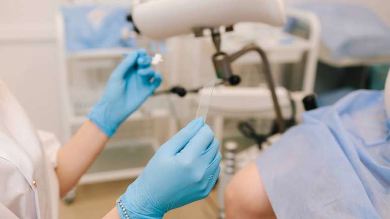 A periodicidade do papanicolau pode variar conforme as diretrizes de cada pa&iacute;s, mas, em linhas gerais, o rastreamento &eacute; recomendado para pessoas com colo do &uacute;tero a partir de determinada idade e que j&aacute; tenham iniciado atividade sexual &ndash; depositphotos.com / rabizo94@gmail.com