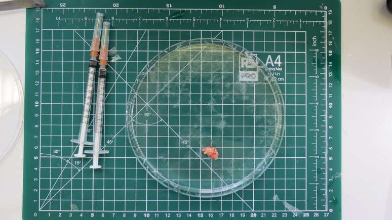 ... e ser&aacute; colocado em gelatina de &aacute;gar para mant&ecirc;-lo no lugar...