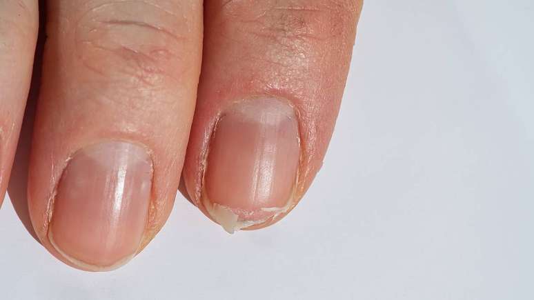 Alimenta&ccedil;&atilde;o equilibrada e rica em nutrientes ajuda a fortalecer as unhas e reduzir a descama&ccedil;&atilde;o &ndash; depositphotos.com / FotoPrivet