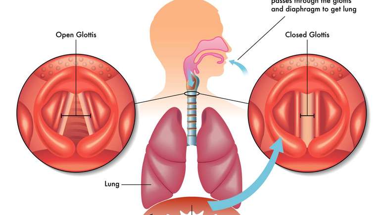 O procedimento &eacute; indicado apenas quando o solu&ccedil;o persiste por dias ou semanas e n&atilde;o responde a tratamentos convencionais &ndash; depositphotos.com / rob3000