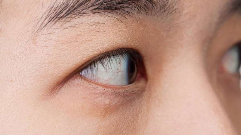 Pesquisas publicadas at&eacute; 2025 t&ecirc;m destacado a import&acirc;ncia de combinar acompanhamento regular com medidas de preven&ccedil;&atilde;o desde a inf&acirc;ncia &ndash; depositphotos.com / FrameAngel