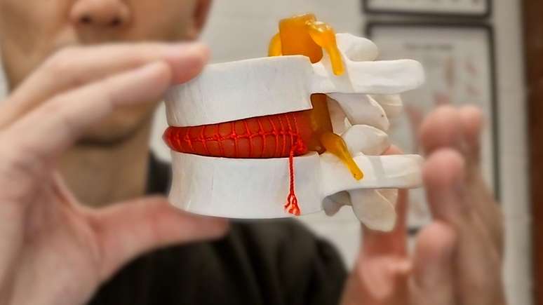 Adam Siu usa um modelo das juntas para mostrar como um disco intervertebral reage quando nos sentamos ou nos curvamos