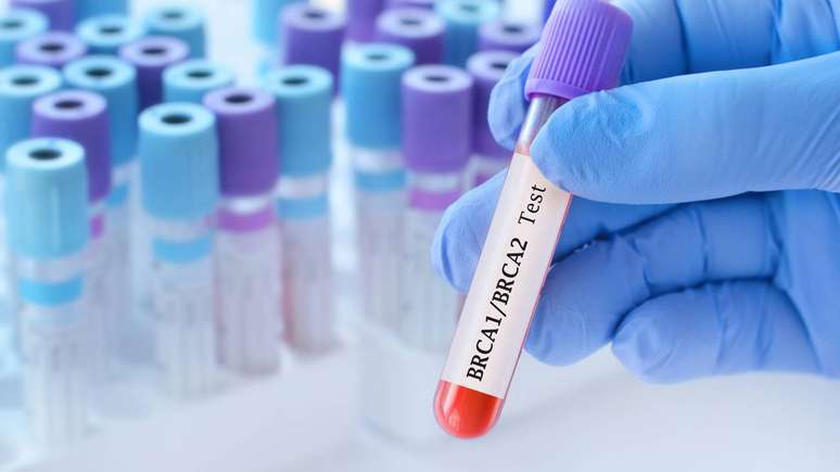 As muta&ccedil;&otilde;es heredit&aacute;rias no gene BRCA2 se associam a um risco mais elevado de determinados tumores em compara&ccedil;&atilde;o com a popula&ccedil;&atilde;o geral &ndash; depositphotos.com / SyhinStas