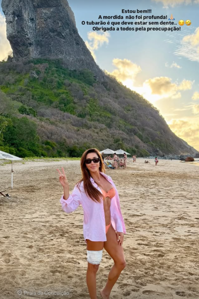 A advogada Tayane Dalazen assegurou estar bem ap&oacute;s ser mordida por um tubar&atilde;o em Fernando de Noronha e brincou sobre a situa&ccedil;&atilde;o: 'Deve estar sem dente'