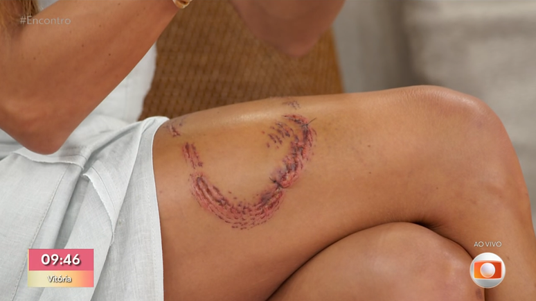 Tayane mostra ferida no Encontro