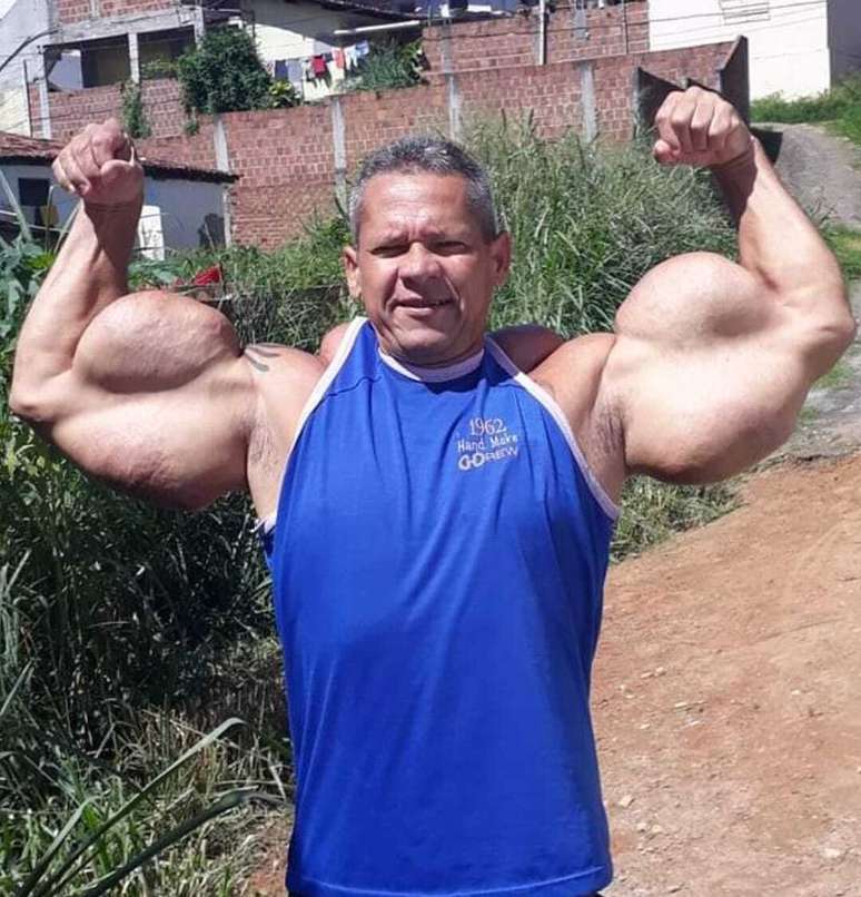 Morre o Popeye Brasileiro aos 55 anos em PE