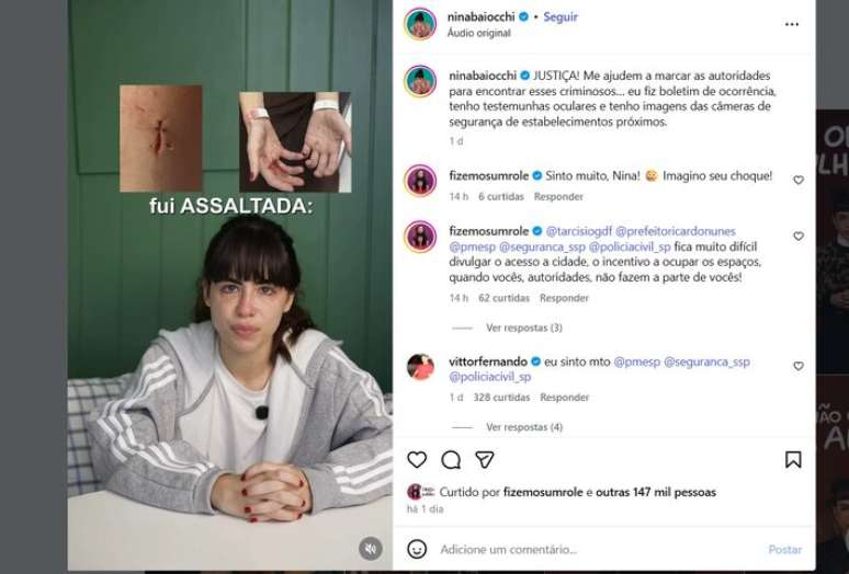 ఎస్పీలో దోపిడీ తర్వాత తన చేతులకు గాయాలు అయినట్లు నటి నివేదించింది