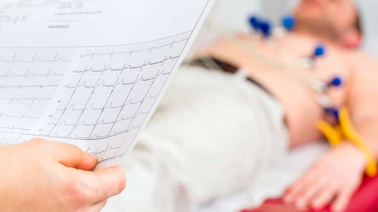 Em vez de ser visto apenas como uma exig&ecirc;ncia burocr&aacute;tica, o eletrocardiograma pode ser incorporado ao planejamento de treinos como ferramenta de preven&ccedil;&atilde;o &ndash; depositphotos.com / Kzenon