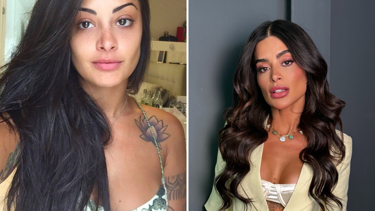 Antes e depois: veja a transforma&ccedil;&atilde;o do rosto de Aline Campos