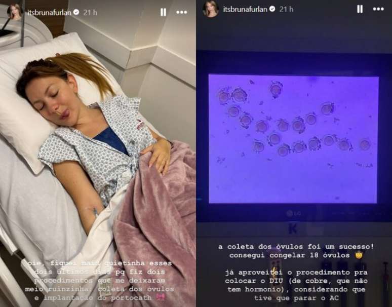 Bruna Furlan explicou o congelamento de &oacute;vulos antes de iniciar a quimioterapia
