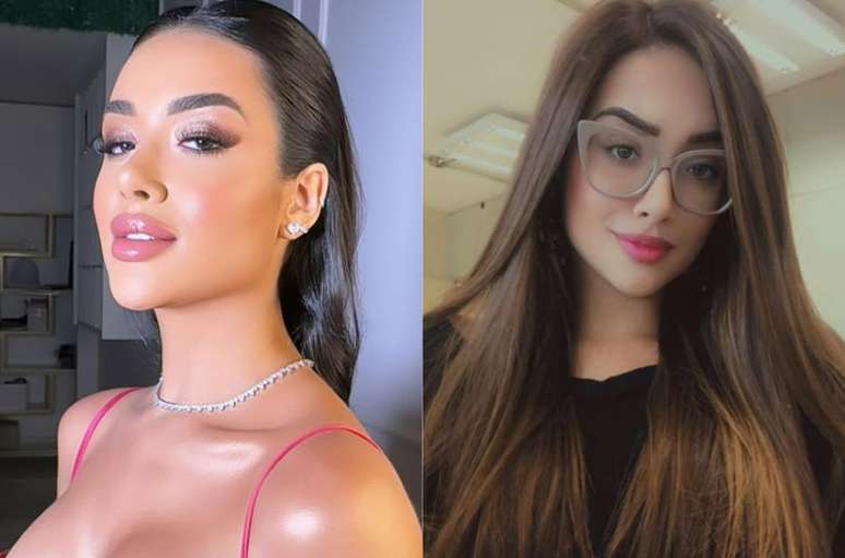 Jordana, do BBB26, realizou harmoniza&ccedil;&atilde;o facial e tamb&eacute;m rinoplastia