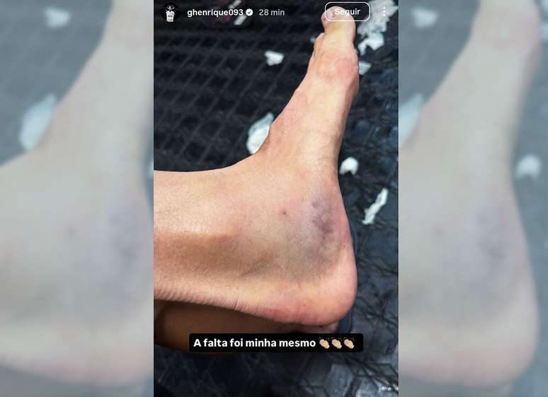 Gustavo Henrique mostra les&atilde;o que sofreu na jogada &ndash;