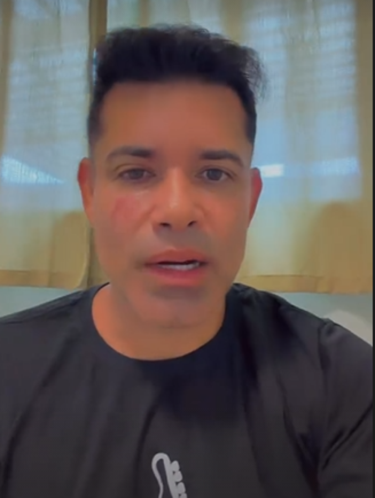 Em v&iacute;deo que relatou o ocorrido &eacute; poss&iacute;vel visualizar o ferimento que o acidente deixou em seu rosto