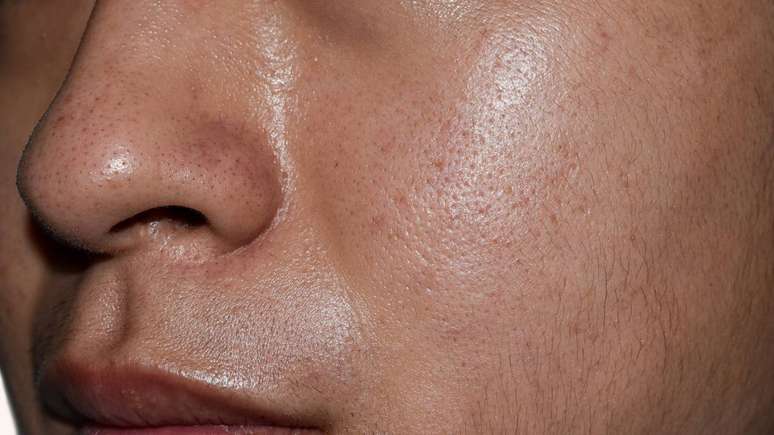 pele oleosa &ndash; depositphotos.com / zaynyinyi