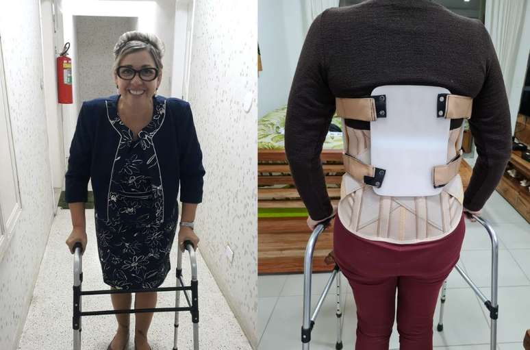 Maria Luzinete Sabino da Silva ficou com sequelas devido &agrave; rea&ccedil;&otilde;es que teve ap&oacute;s tomar um 'combo de vacinas'