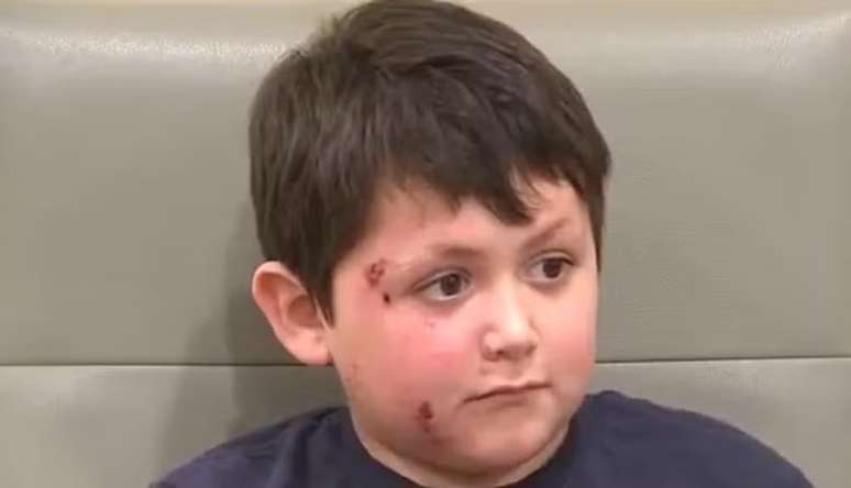 Caleb apresenta boa recupera&ccedil;&atilde;o ap&oacute;s o acidente