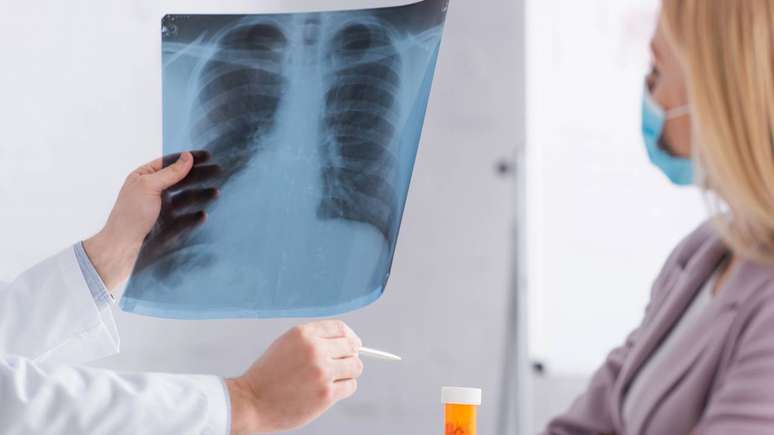 pulm&atilde;o &ndash; depositphotos.com / HayDmitriy