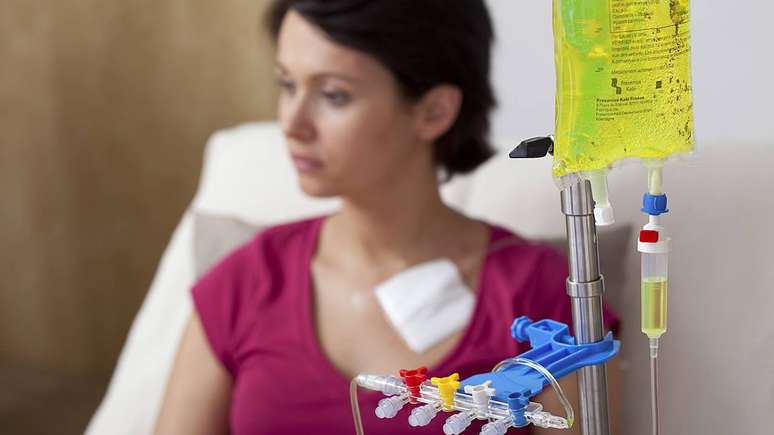Apesar de os achados serem promissores e abrirem uma nova frente de discuss&atilde;o na oncologia, especialistas alertam que ainda h&aacute; lacunas importantes antes que servi&ccedil;os de sa&uacute;de reorganizem completamente suas agendas de infus&atilde;o com foco no hor&aacute;rio &ndash; depositphotos.com / imagepointfr