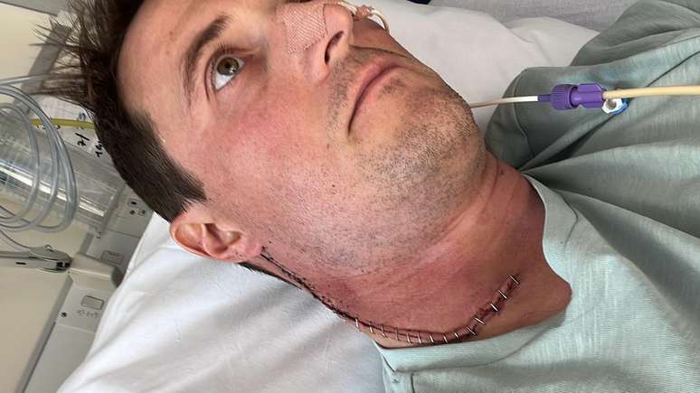 Durante a opera&ccedil;&atilde;o, os cirurgi&otilde;es removeram 44 g&acirc;nglios linf&aacute;ticos de seu pesco&ccedil;o