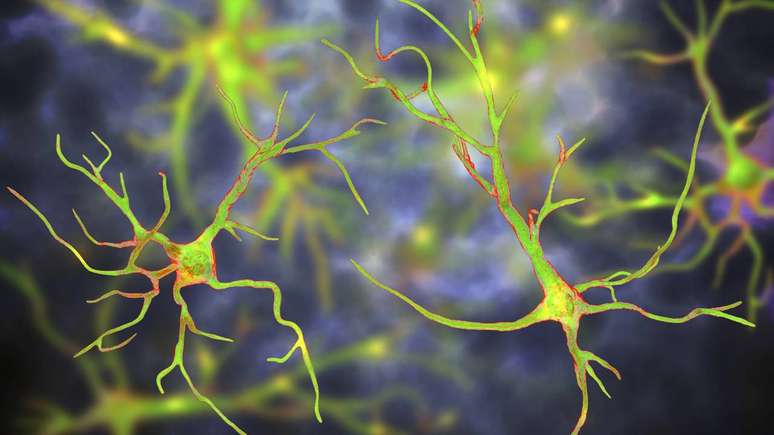 A Esclerose Lateral Amiotr&oacute;fica &eacute; uma doen&ccedil;a neurodegenerativa que atinge os neur&ocirc;nios motores, c&eacute;lulas respons&aacute;veis por enviar comandos do c&eacute;rebro e da medula espinhal para os m&uacute;sculos &ndash; depositphotos.com / katerynakon