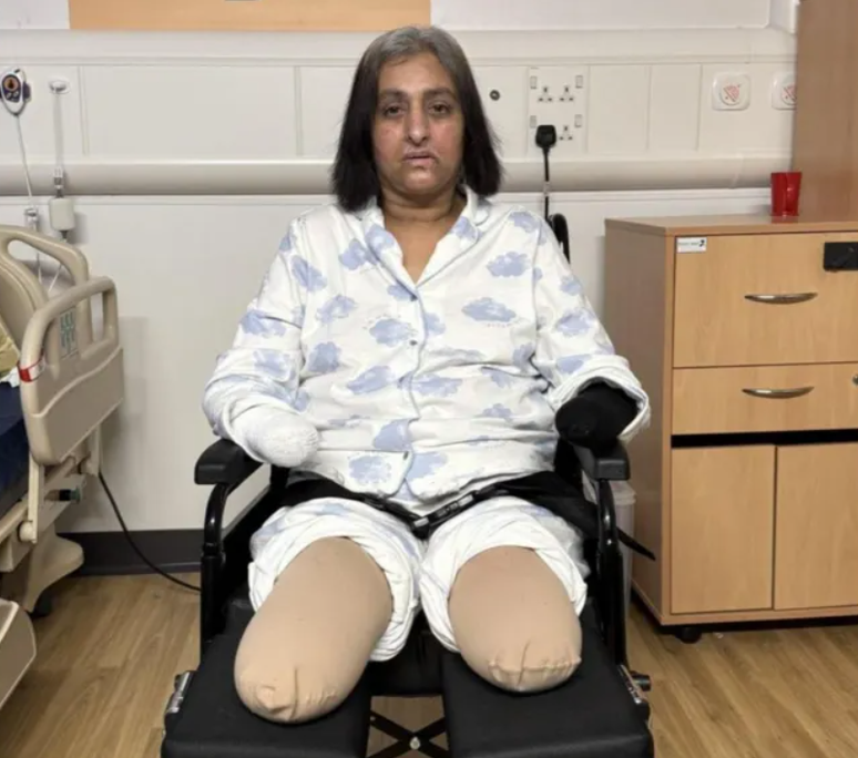 Mulher sofre amputa&ccedil;&atilde;o das m&atilde;os e pernas ap&oacute;s sepse causa por lambida de pet na Inglaterra