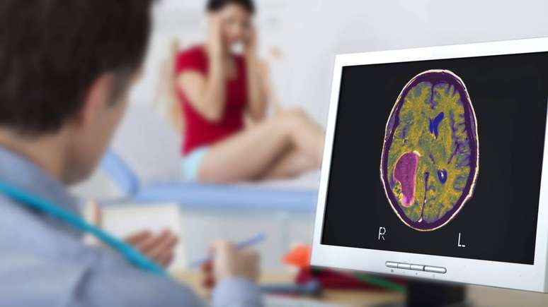 Com o tempo, surgiram manifesta&ccedil;&otilde;es neurol&oacute;gicas, como lapsos de mem&oacute;ria, altera&ccedil;&otilde;es de humor e dores de cabe&ccedil;a &ndash; depositphotos.com / imagepointfr