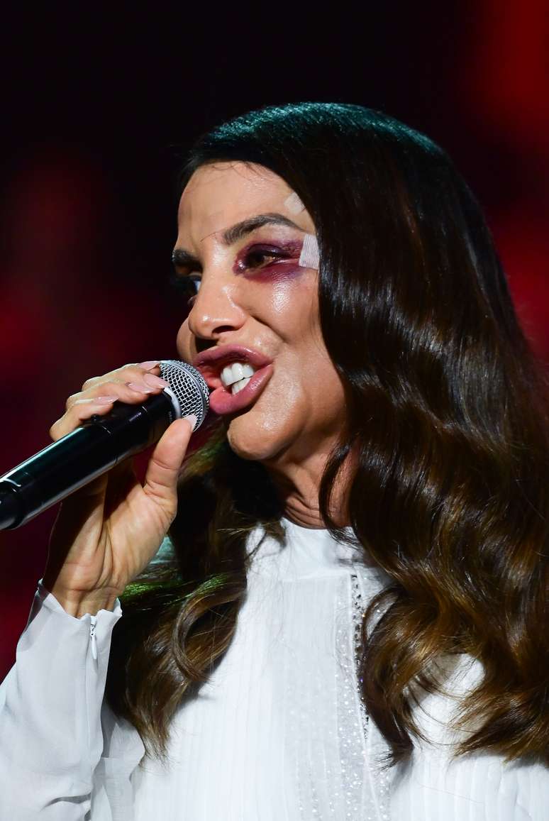 Ivete Sangalo fez show no Gin&aacute;sio do Ibirapuera ap&oacute;s sofrer acidente dom&eacute;stico e ficar com olho roxo