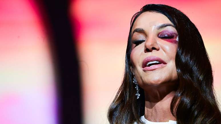 Ivete Sangalo fez show no Gin&aacute;sio do Ibirapuera ap&oacute;s sofrer acidente dom&eacute;stico e ficar com olho roxo