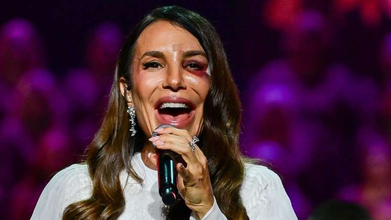 Ivete Sangalo fez show no Gin&aacute;sio do Ibirapuera ap&oacute;s sofrer acidente dom&eacute;stico e ficar com olho roxo