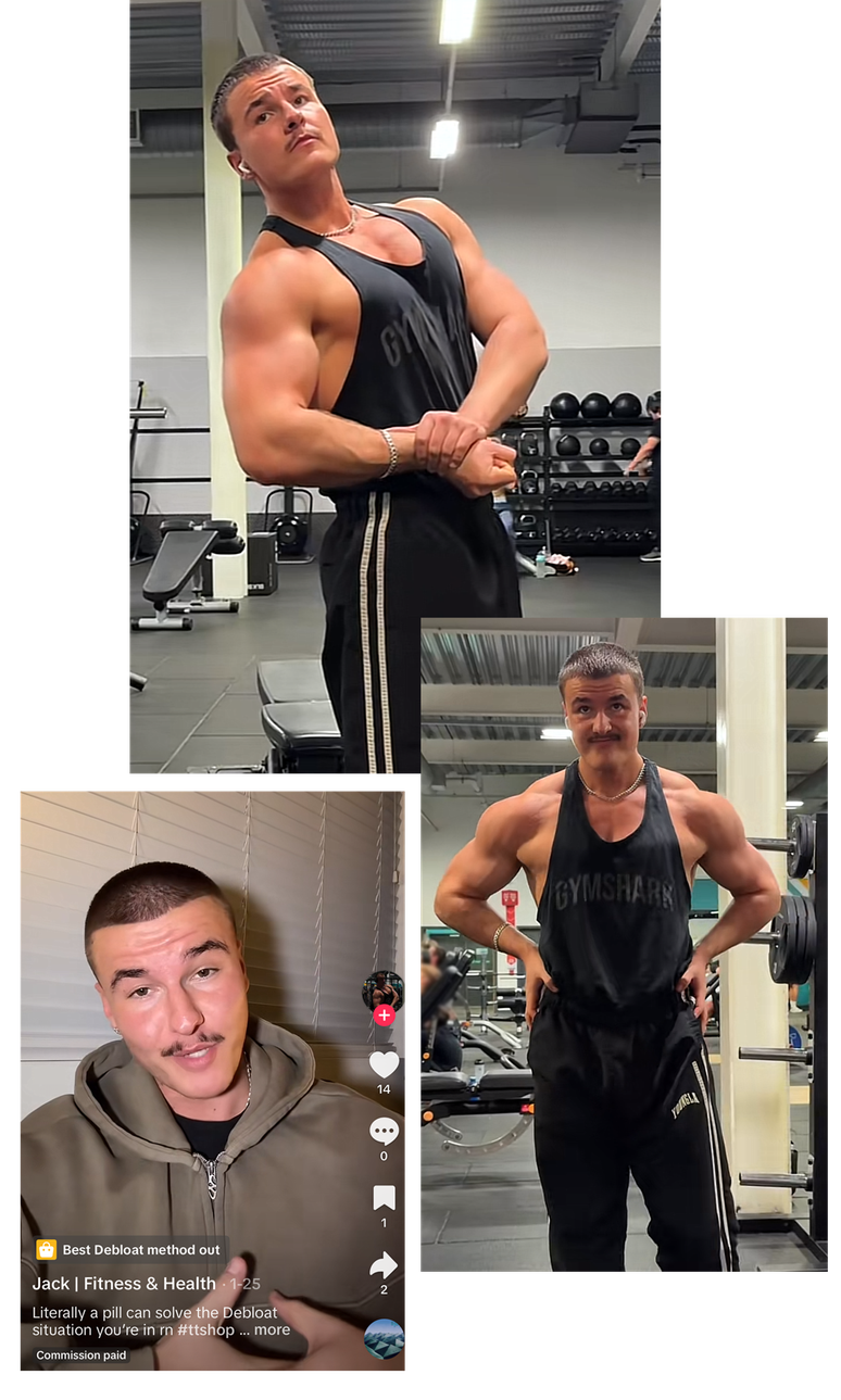 Antes de experimentar os pept&iacute;deos, Jack Sarginson foi ao m&eacute;dico e recebeu sess&otilde;es de fisioterapia