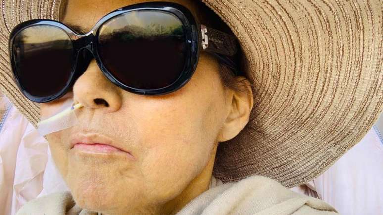 A pele de Caroline ficou amarelada enquanto ela aguardava o transplante