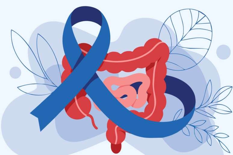 A atividade f&iacute;sica &eacute; uma aliada contra o c&acirc;ncer colorretal