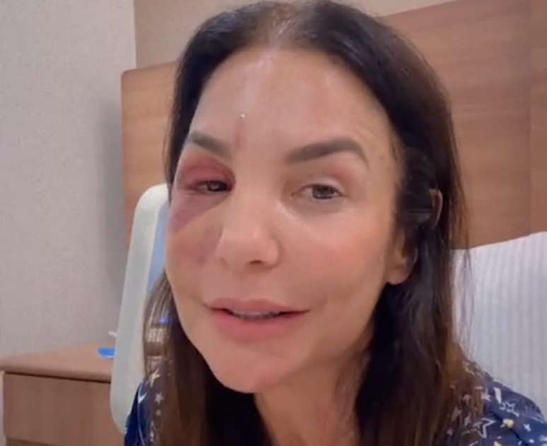 Ivete Sangalo ఆరోగ్య స్థితిని అప్‌డేట్ చేసారు