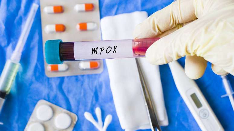 O aumento recente de casos de mpox em diferentes pa&iacute;ses reacendeu d&uacute;vidas sobre sua rela&ccedil;&atilde;o com a antiga var&iacute;ola humana &ndash; depositphotos.com / flashback313@gmail.com