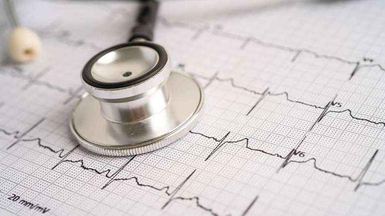 Em casos de suspeita de arritmia costuma haver a solicita&ccedil;&atilde;o de um eletrocardiograma (ECG), exame simples e r&aacute;pido que registra a atividade el&eacute;trica do cora&ccedil;&atilde;o &ndash; depositphotos.com / chormail@hotmail.com