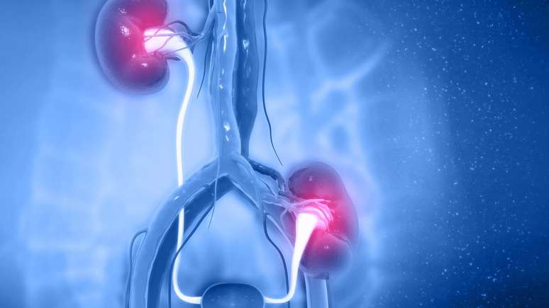 కొన్ని సందర్భాల్లో, తీవ్రమైన గుండె జబ్బులు, క్రియాశీల ఇన్ఫెక్షన్లు, ఇటీవలి క్యాన్సర్ లేదా శస్త్రచికిత్స ప్రమాదాన్ని పెంచే ఇతర పరిస్థితులతో బాధపడుతున్న రోగులలో క్లినికల్ పిక్చర్ మార్పిడిని నిరోధిస్తుంది - depositphotos.com / crytallight