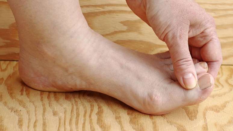 Para reduzir o risco de fungos nas unhas dos p&eacute;s e apoiar qualquer tratamento, os cuidados di&aacute;rios s&atilde;o essenciais &ndash; depositphotos.com / astrid208