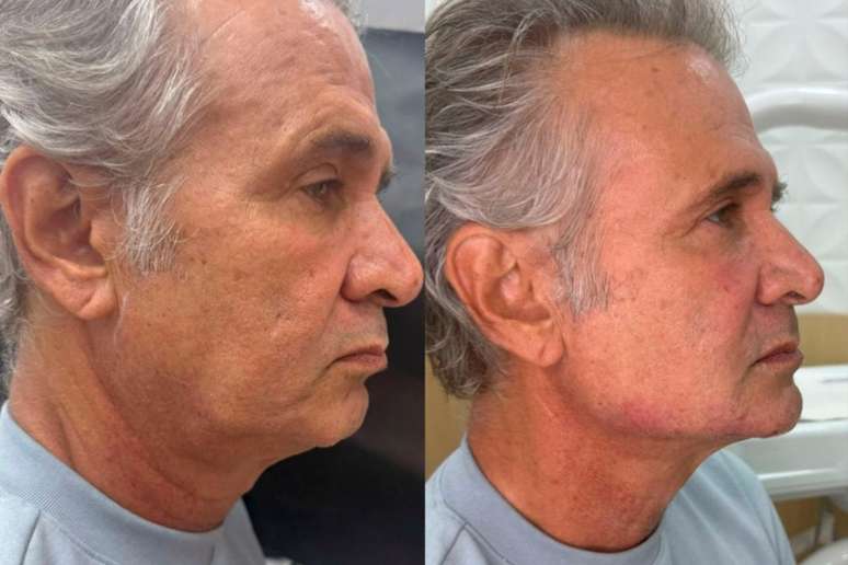 Ator Nelson Freitas passa por transforma&ccedil;&atilde;o visual