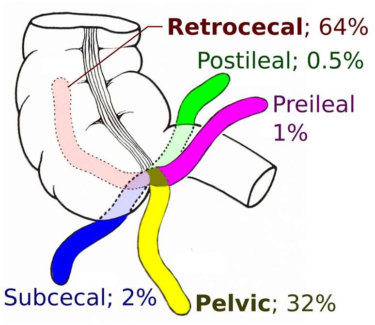 Diagrama de um segmento do intestino delgado com dedos do ap&ecirc;ndice orientados em v&aacute;rios graus