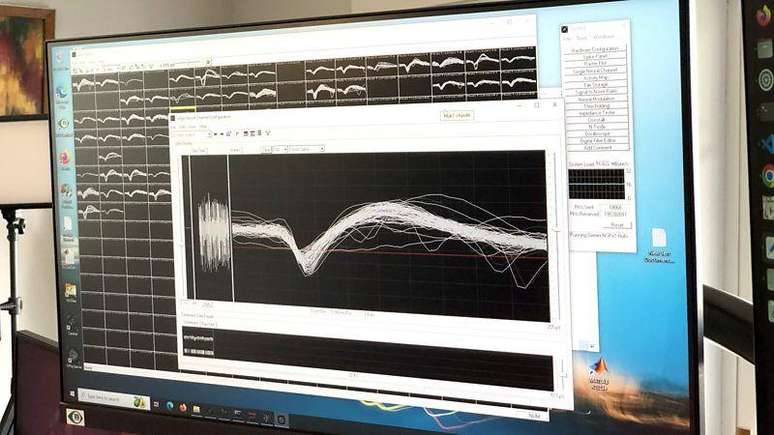 O nosso c&eacute;rebro brilha com sinais el&eacute;tricos e a intelig&ecirc;ncia artificial permite que os cientistas os compreendam