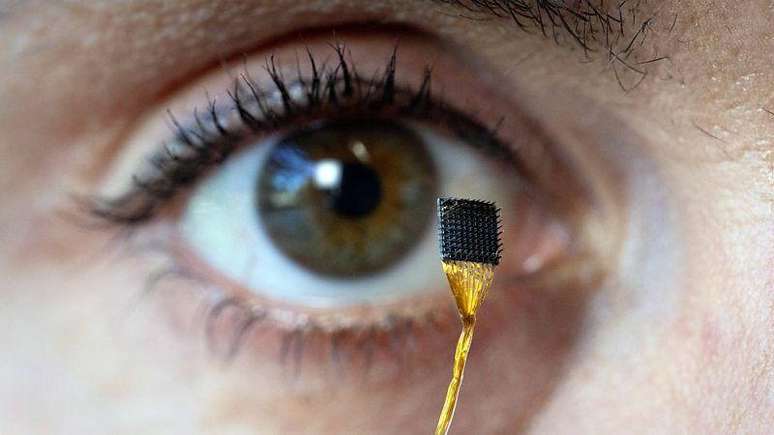 Os microeletrodos podem retirar amostras da atividade de centenas de neur&ocirc;nios. Quanto mais os dispositivos progridem, maior a quantidade de informa&ccedil;&otilde;es que eles coletam