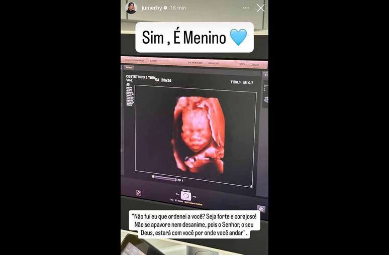 Juliana Merhy revelou o sexo do beb&ecirc; nas redes sociais &ndash;