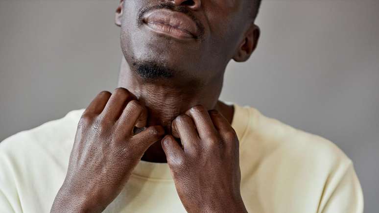 ఒత్తిడి దురదను మరింత తీవ్రతరం చేస్తుంది మరియు దురద ఒత్తిడిని మరింత తీవ్రతరం చేస్తుంది