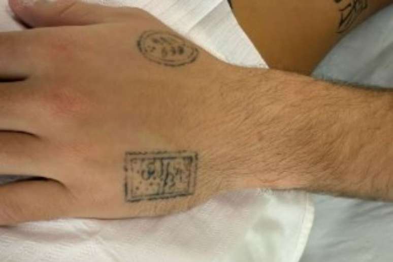 Jo&atilde;o Guilherme retira tatuagens