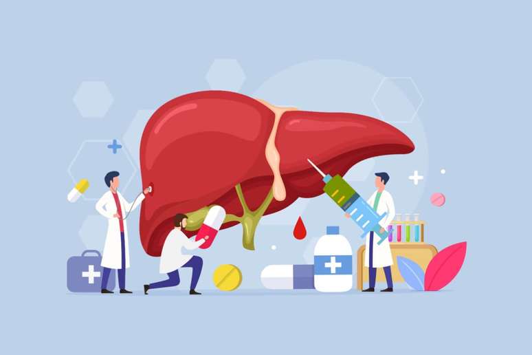 A esteatose hep&aacute;tica, quando n&atilde;o monitorada adequadamente, pode evoluir para formas inflamat&oacute;rias mais graves, elevando o risco de fibrose, cirrose e c&acirc;ncer hep&aacute;tico 