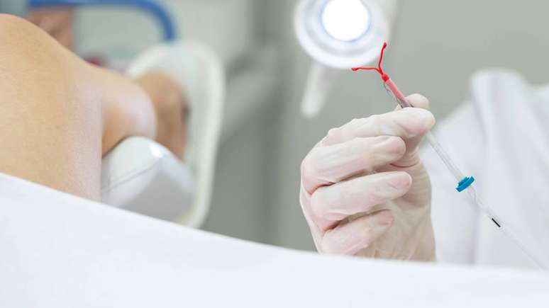 O DIU hormonal costuma ser bem alinhado ao perfil de pessoas que desejam um m&eacute;todo de longa dura&ccedil;&atilde;o e, ao mesmo tempo, querem reduzir sintomas ligados &agrave; menstrua&ccedil;&atilde;o &ndash; depositphotos.com / mariakray