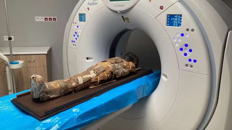Exames como tomografia foram realizados para avaliar o interior da mumifica&ccedil;&atilde;o sem danific&aacute;-la
