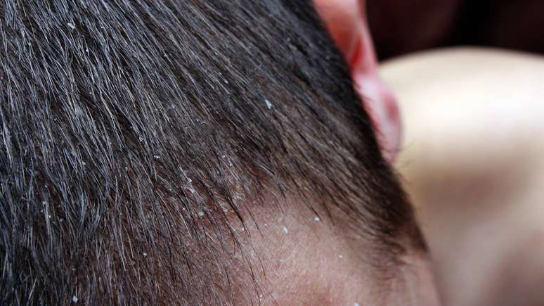 caspa &ndash; depositphotos.com / Adam88xxx