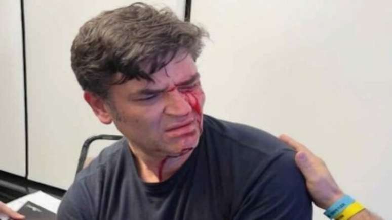 Rosto de Duda Lima ficou ensanguentado ap&oacute;s soco desferido por assessor de Mar&ccedil;al