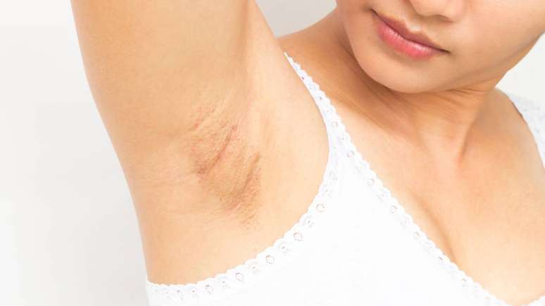 Axila &ndash; depositphotos.com / mraoraor